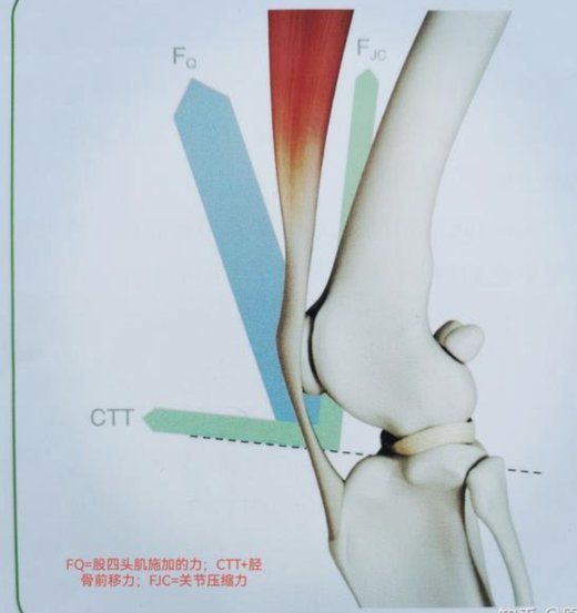 维拉中场奥纳纳ACL断裂术后需9个月康复