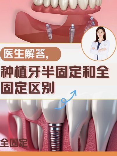 桑德兰3000万+1000万报价卡塔莫，葡体要求固定4000万不能少